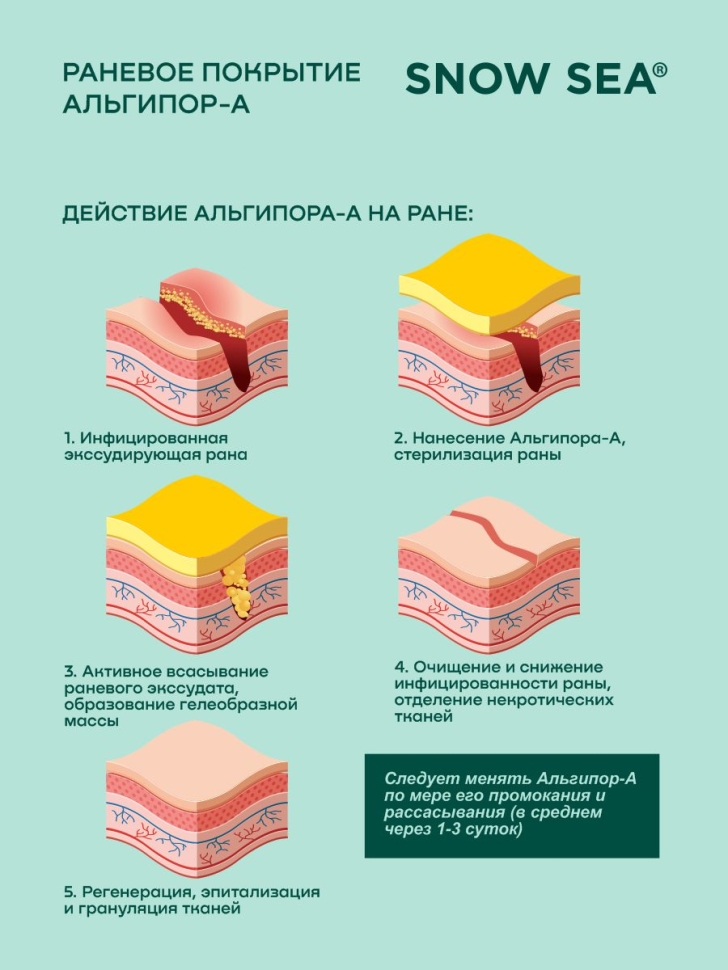 Альгипор-А покрытие (повязка) на раны и ожоги 50х50х10