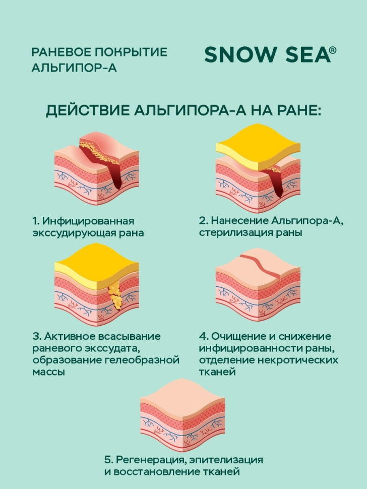 Альгипор-А покрытие (повязка) на раны и ожоги 50х50х10 мм, 5 шт